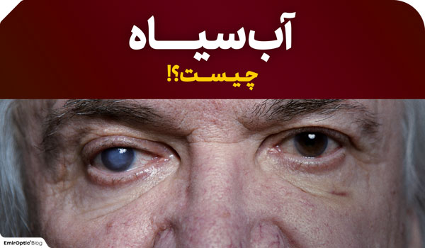 گلوکوم آب سیاه