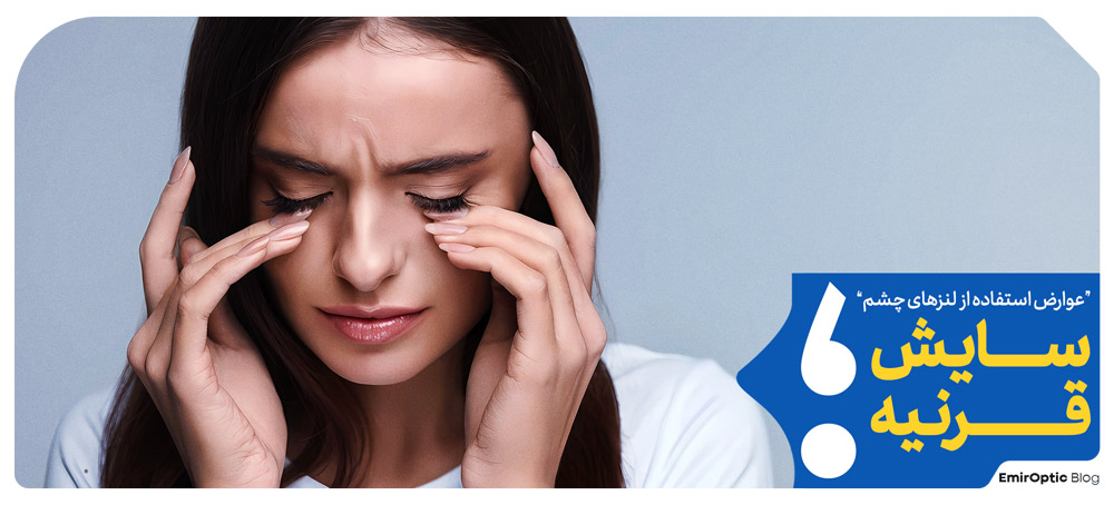 سایش قرنیه