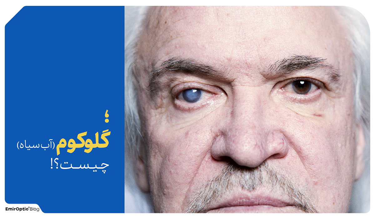 گلوکوم آب سیاه چیست