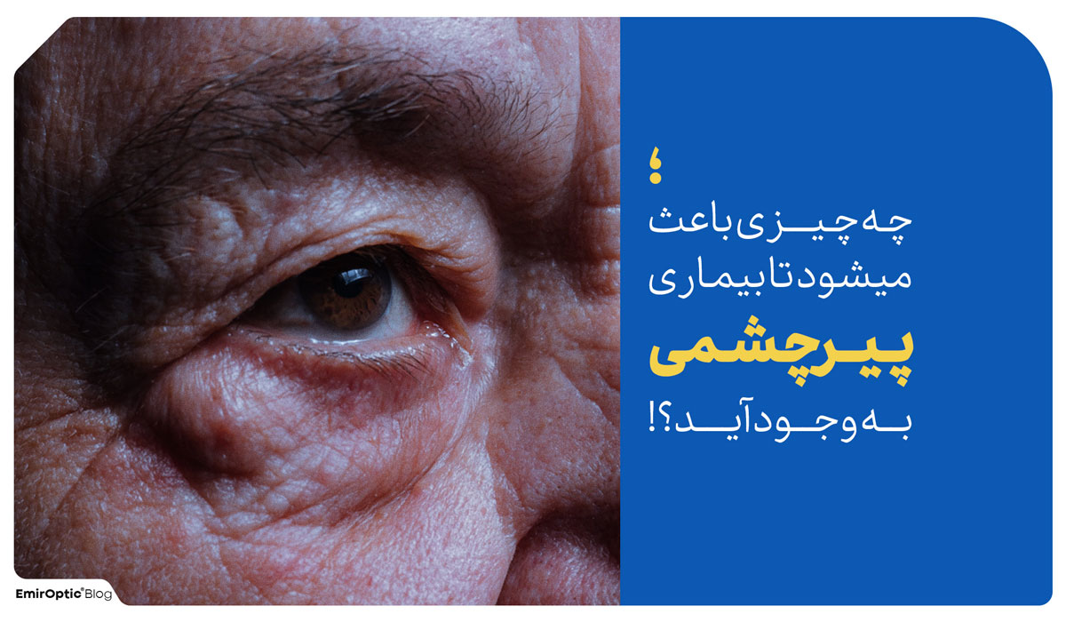 چرا پیرچشمی میگیریم