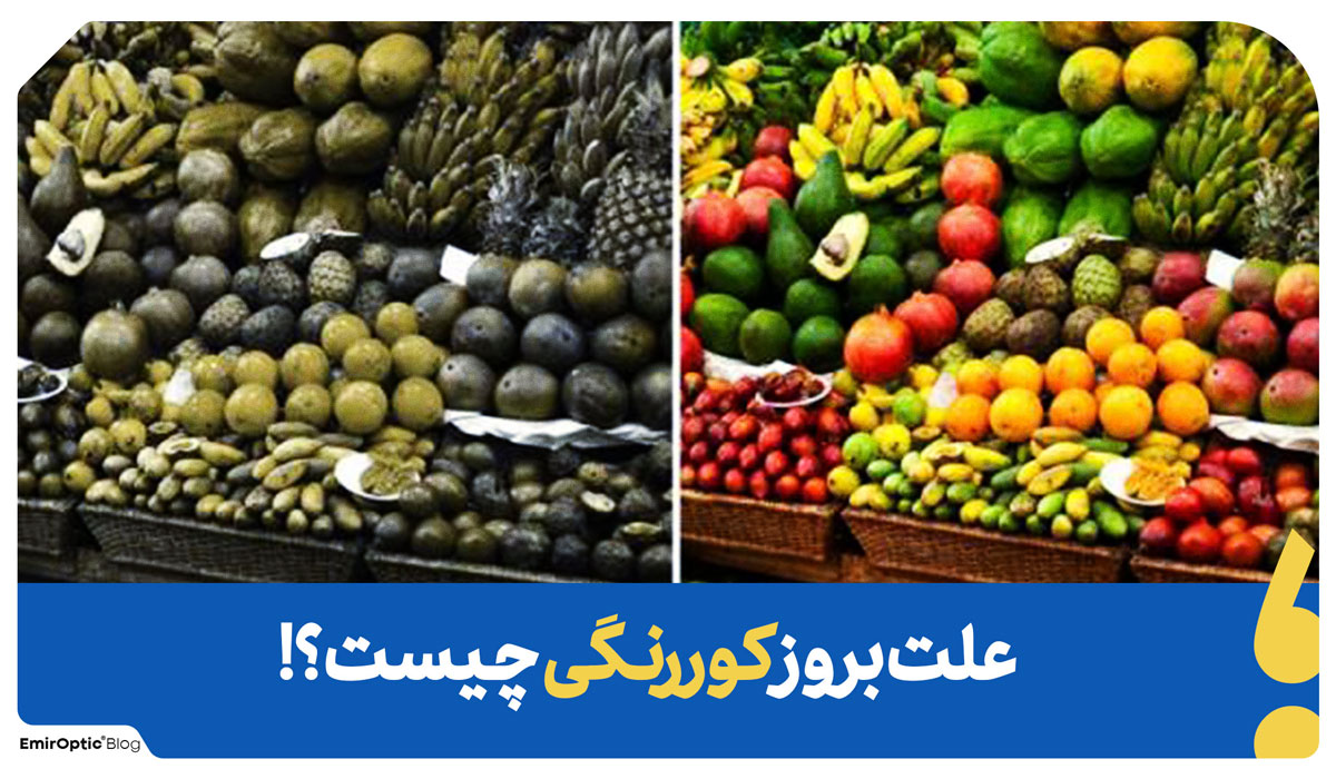 علت کور رنگی