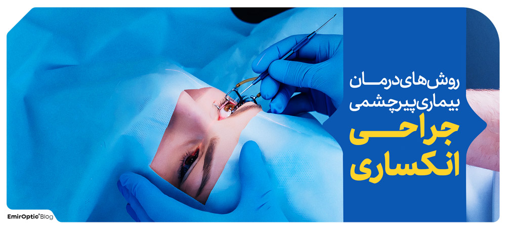 جراحی انکساری