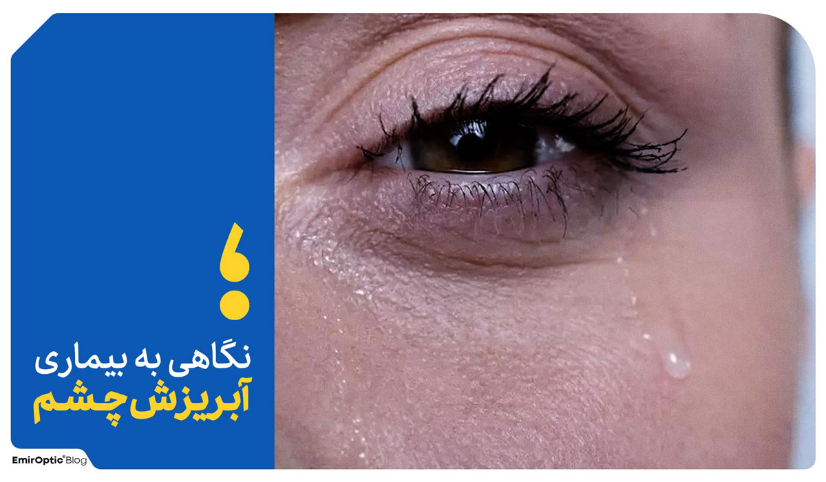 آبریزش چشم