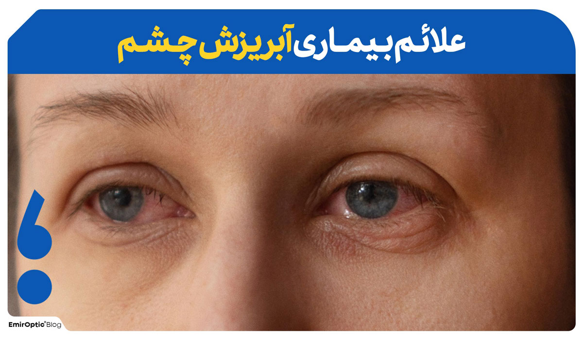 علائم آبریزش چیست