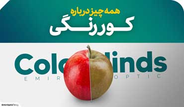 کور رنگی و ۴ روش درمان