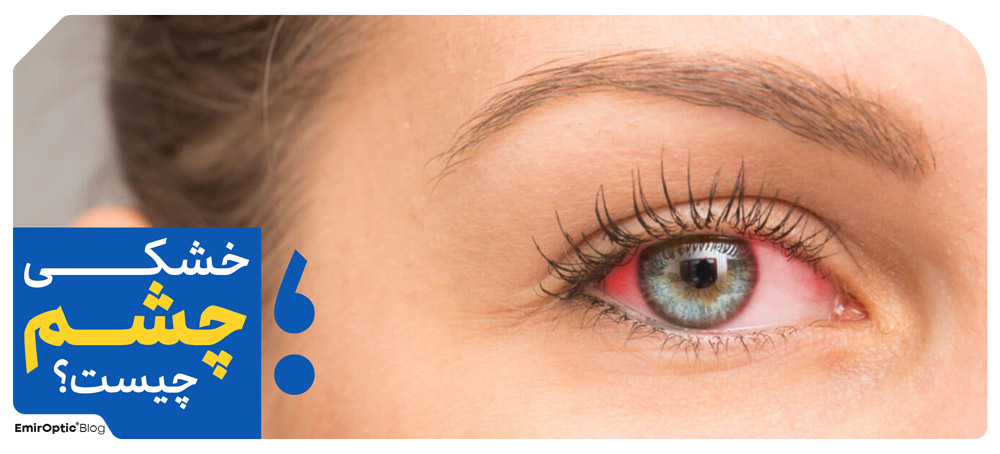 خشکی چشم چیست