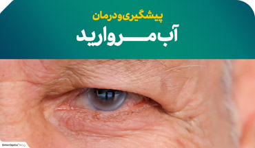 درمان و پیشگیری از آب مروارید