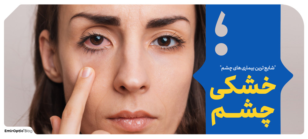 خشکی چشم