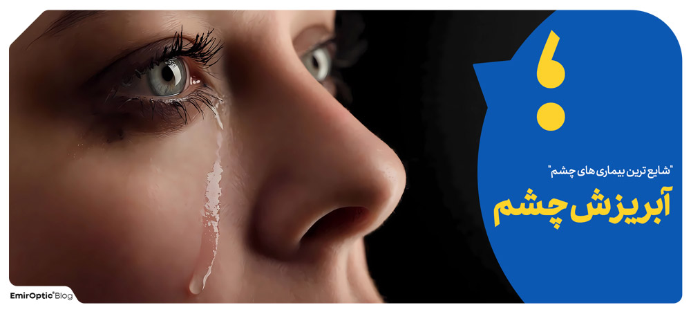 آبریزش چشم