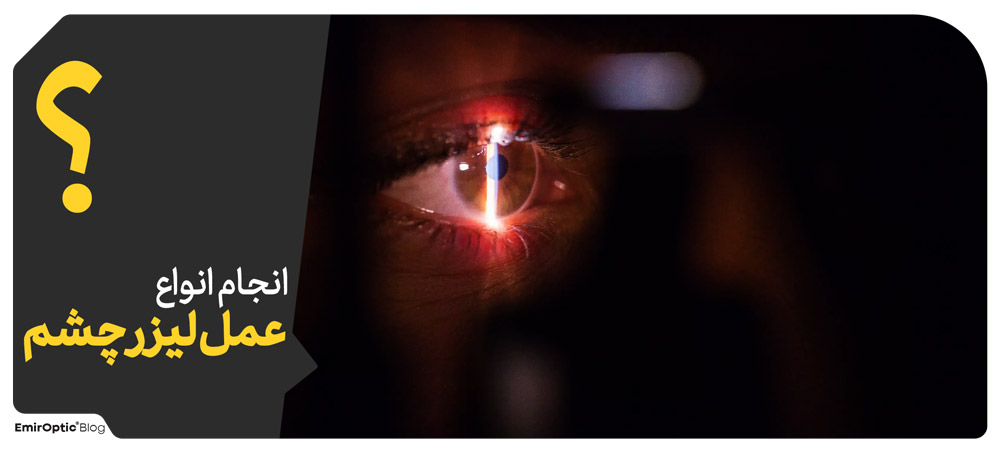 انجام انواع عمل لیزر چشم