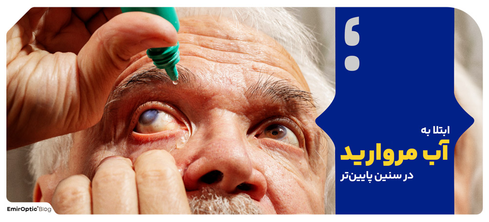 ابتلا به آب مروارید در سنین پایین‌تر
