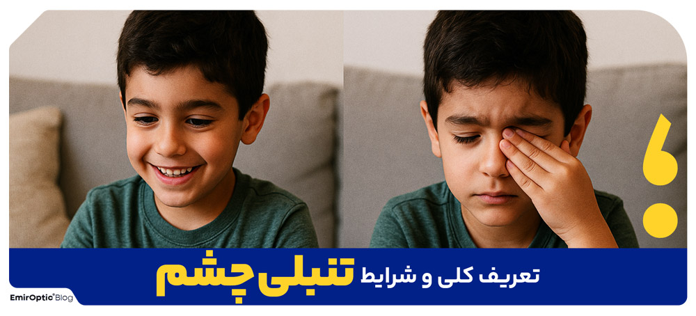 تعریف کلی و شرایط تنبلی چشم