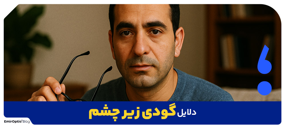 دلایل گودی زیر چشم