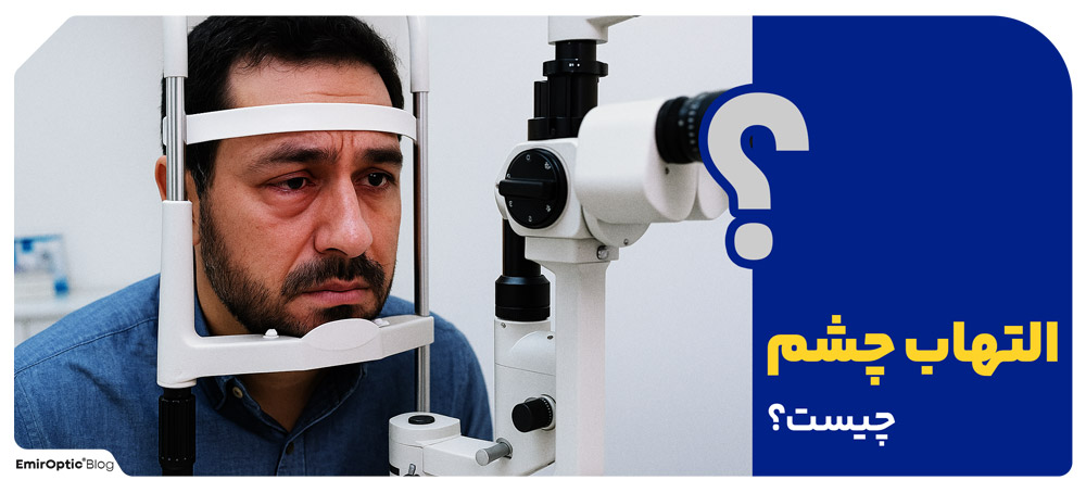 التهاب چشم چیست؟