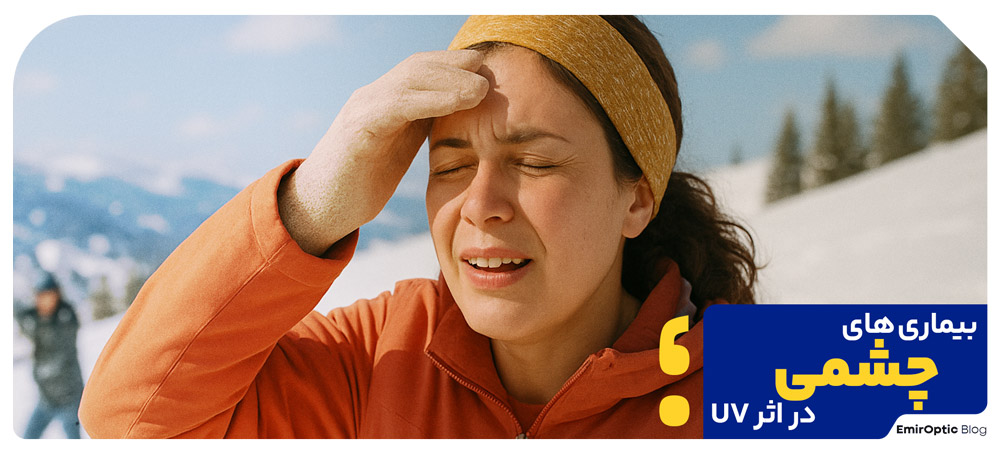 بیماری های چشمی در اثر UV