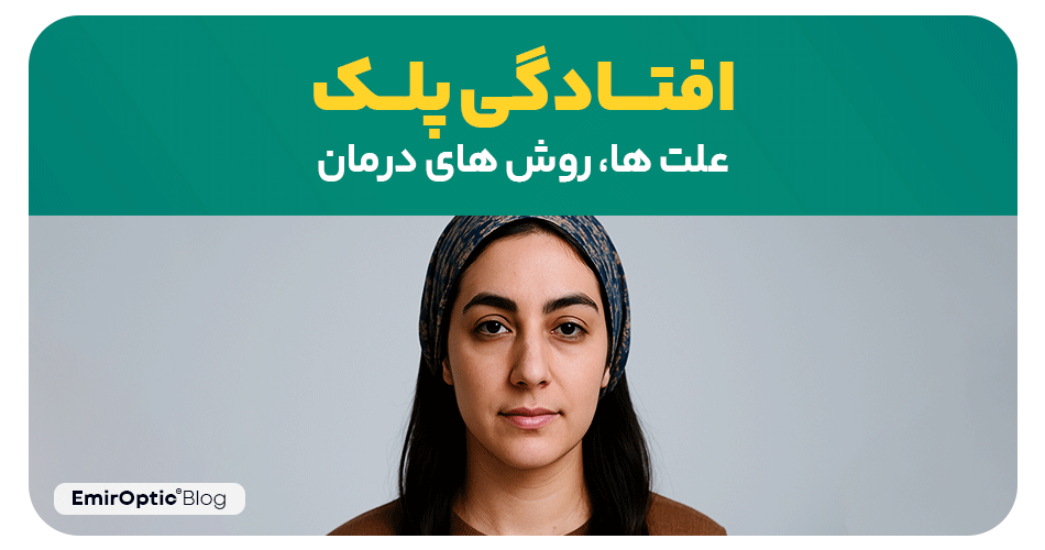 افتادگی پلک